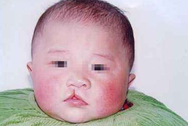 揭秘上海宏康醫(yī)院王鈺杰醫(yī)生私密整形技術(shù)：專業(yè)還是坑？