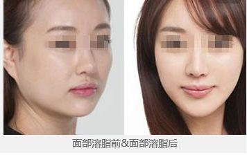哈爾濱美佳娜醫(yī)療美容醫(yī)院靠譜嗎？真實評價和價格收費清單