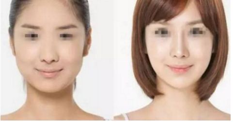 上海九院整形豐唇價格2023公布！蔣朝華醫(yī)生案例、口碑揭秘，值得關注！