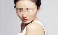 鎮(zhèn)江玻尿酸注射優(yōu)質(zhì)醫(yī)院推薦及價格參考