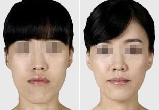 西安口碑好的整形醫(yī)院推薦：實(shí)力強(qiáng)勁，值得信賴