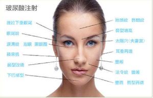 張家口第四醫(yī)院整形美容科效果如何？分享最新吸脂手術(shù)案例及醫(yī)院詳情