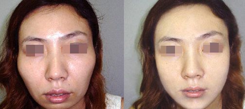 深圳花樣年醫(yī)療美容診所：口碑揭秘，項目收費一覽