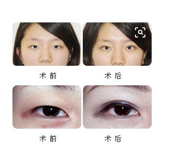 肇慶市首家吸脂修復(fù)醫(yī)院是哪家？