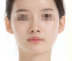 紹興人民醫(yī)院美容科：體驗(yàn)高超醫(yī)術(shù)，解鎖青春靚顏