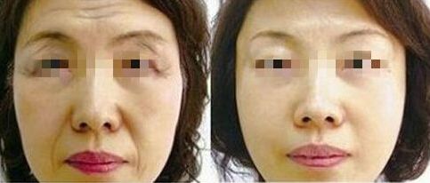 北京同仁眼科夜間急診掛號攻略及醫(yī)生指南