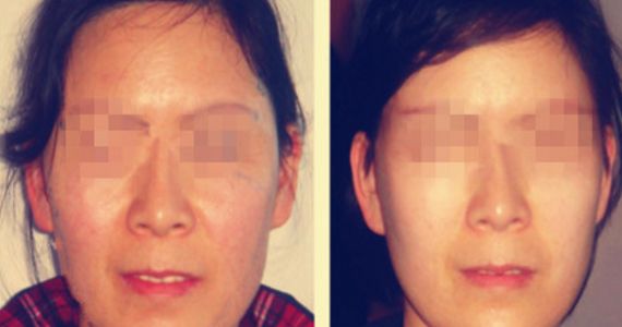 深圳熱門植發(fā)醫(yī)院排行榜：探索新生、雍禾、碧蓮盛的口碑佳選