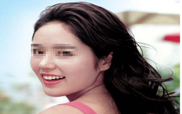 沈陽(yáng)大腿吸脂達(dá)人榜  打造美腿，盡在掌握