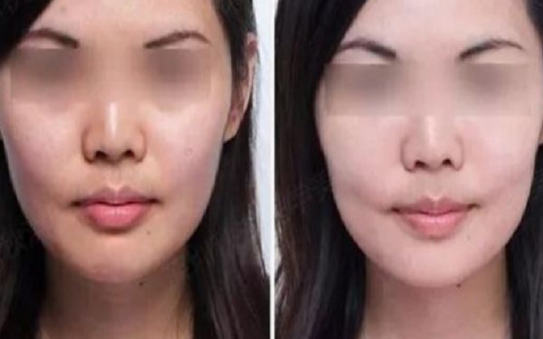 抗衰老秘密解碼：北京加減美整形的黑科技大揭秘