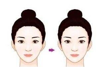 運(yùn)城海鷗整形美容術(shù)后評(píng)價(jià)：真實(shí)吸脂塑形案例分享