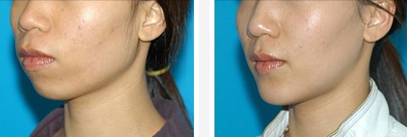 李慶意醫(yī)生：婦科疾病診療專家，解析技術(shù)實力與典型案例