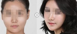 貴州哪家醫(yī)院吸脂好？美萊世紀(jì)醫(yī)院受矚目
