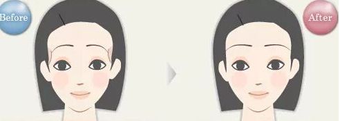 貴陽云巖區(qū)哪家整形醫(yī)院的吸脂效果好？