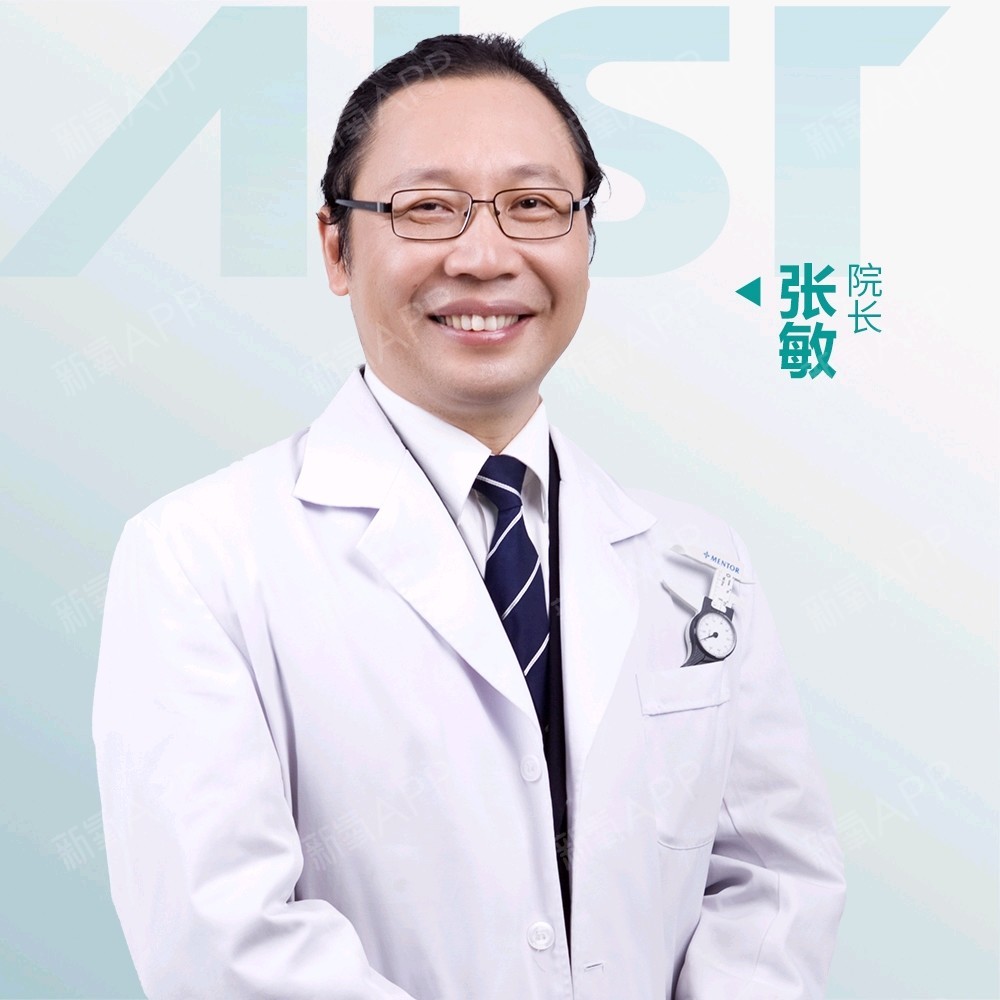 張敏