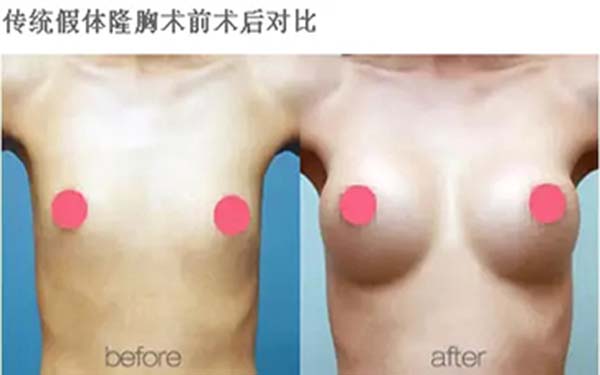 上海面部皮膚除皺價格一般多少(2023上海面部皮膚除皺參考價：3444-6085元)