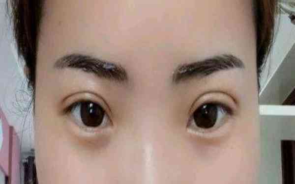 臺(tái)州溶脂減肥手術(shù)價(jià)格表瀏覽(2023臺(tái)州溶脂減肥手術(shù)參考價(jià)：4115-5885元)