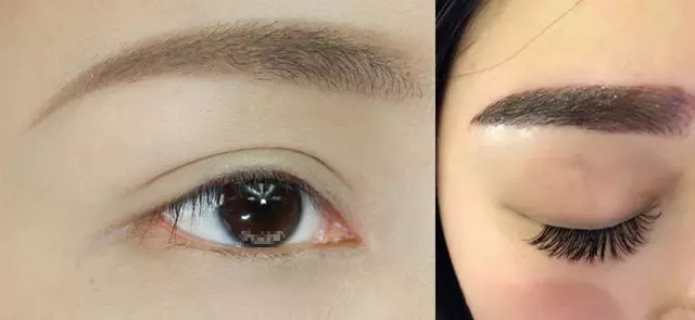 福州瓜子臉整形價目表全面呈現(xiàn)(2023福州瓜子臉整形參考價為：6578元)