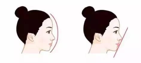 達(dá)州光子去眼紋整形價(jià)位表剖析(2023達(dá)州光子去眼紋參考價(jià)為：5156元)