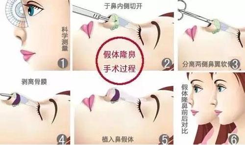 內(nèi)江毛細(xì)血管瘤價(jià)格一覽表預(yù)覽(2023內(nèi)江毛細(xì)血管瘤參考價(jià)為：5173元)