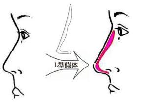 西安深皺紋消除收費價目表2023查看(2023西安深皺紋消除參考價為：5501元)