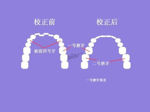 山西韓國(guó)宮廷隆鼻治療價(jià)格公示公開(kāi)(2023山西韓國(guó)宮廷隆鼻參考價(jià)為：6692元)