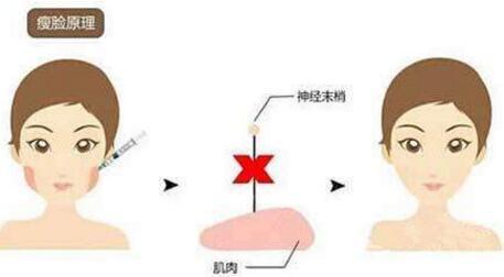 長(zhǎng)春點(diǎn)陣激光磨削的手術(shù)費(fèi)用明細(xì)一覽(2023長(zhǎng)春點(diǎn)陣激光磨削參考價(jià)為：6512元)