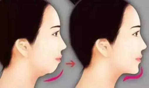 ?？陧n式精致改臉術(shù)手術(shù)價錢(2023?？陧n式精致改臉術(shù)參考價為：5036元)