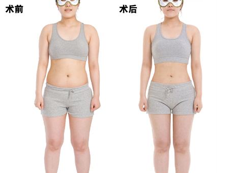 長(zhǎng)沙玻尿酸魚尾紋填充費(fèi)用明細(xì)(2023長(zhǎng)沙玻尿酸魚尾紋填充參考價(jià)為：5684元)