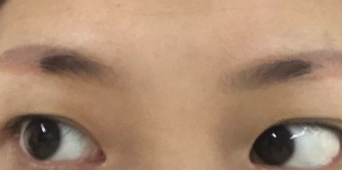 保定重癥破裂處女膜修補(bǔ)收費(fèi)價(jià)目表明細(xì)上線(2023保定重癥破裂處女膜修補(bǔ)參考價(jià)為：6218元)