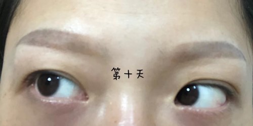 蘇州膠原蛋白豐面頰價格多少貴不貴(2023蘇州膠原蛋白豐面頰參考價為：5115元)