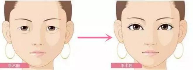 合肥韓式吸脂減肥瘦腰費用趨勢圖展示(2023合肥韓式吸脂減肥瘦腰參考價為：7032元)