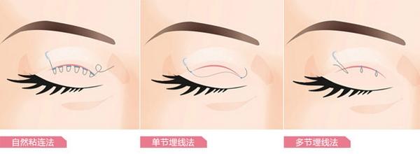 南充眼部護(hù)理優(yōu)惠價錢查詢(2023南充眼部護(hù)理參考價為：6636元)