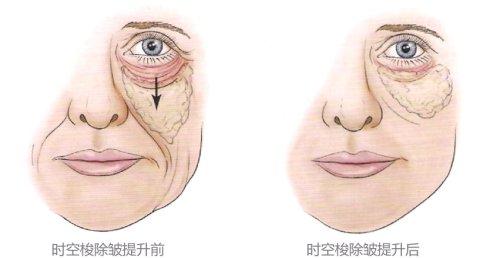 哈爾濱自體脂肪活細(xì)胞豐唇的費(fèi)用多少錢一覽(2023哈爾濱自體脂肪活細(xì)胞豐唇參考價(jià)為：6139元)