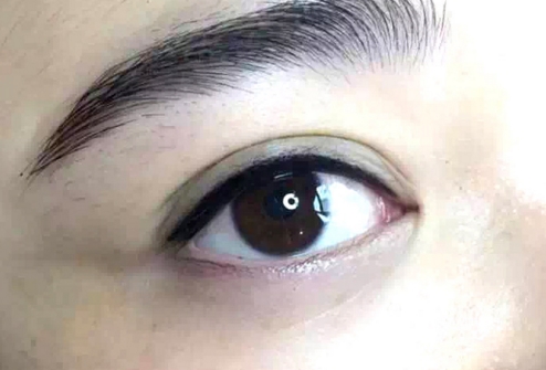 重慶顴骨降低整形價格一般是多少錢(2023重慶顴骨降低整形參考價：4169-5518元)