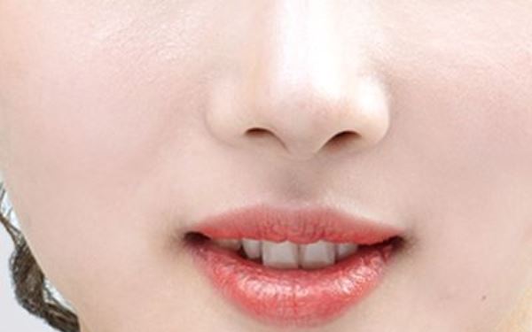 鞍山皮膚松弛彈性提升緊致整形價格明細(xì)查詢(2023鞍山皮膚松弛彈性提升緊致參考價：5971-7203元)