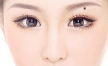 西安自體脂肪填充眼瞼凹陷的價(jià)格震撼發(fā)布(2023西安自體脂肪填充眼瞼凹陷參考價(jià)：5074-6207元)