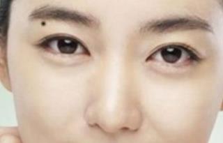 濰坊無(wú)創(chuàng)去眼袋手術(shù)價(jià)錢(qián)查看(2023濰坊無(wú)創(chuàng)去眼袋參考價(jià)：4493-5822元)