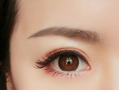 蘭州隆胸修復(fù)手術(shù)價(jià)格是否很貴呢(2023蘭州隆胸修復(fù)手術(shù)參考價(jià)：3881-6088元)