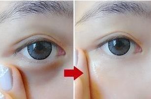 天津脂肪填充太陽穴醫(yī)院最新排行榜及價格概覽（更新至2025年）