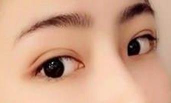 2023杭州熱瑪吉去除法令紋醫(yī)生在榜名單前10名自查！李營、趙雅雄、呂敏解鎖前三名~