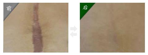 2023北京無針?biāo)鈴?fù)發(fā)正規(guī)醫(yī)生榜單TOP10強(qiáng)哪里做得好？顧建成、趙錦壯、劉珍君實(shí)力不可小覷