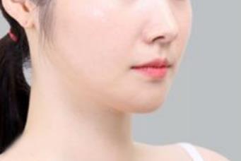 2023威海麗芙莎EPT自體抗衰TOP10醫(yī)生排行榜重磅推薦！李景方、李相根、鐘黎明醫(yī)技太出挑！