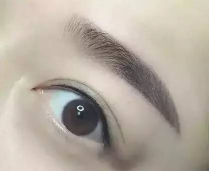 2023成都祛下眼皮皺紋前十位醫(yī)生排名不踩雷！李欣穎、王欣、張志波選了不虧~