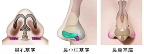 2023北京微創(chuàng)手術(shù)去眉間紋正規(guī)醫(yī)生排名前十哪幾個好！秦月、羅羽、王成元深受愛美者信賴！