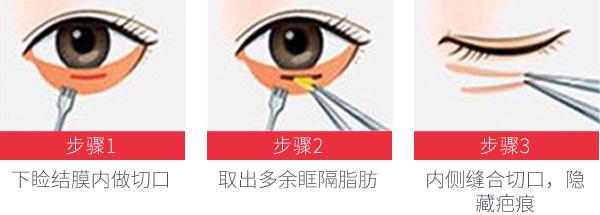 2023廣州小刀針去皺前10醫(yī)生排行榜名單分享！楊曉雙、穆鈺、鐘金源公立醫(yī)美牽頭