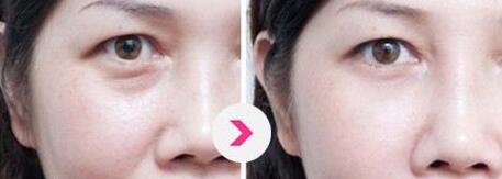 2023?？赗OSE藍(lán)玫瑰逆齡提拉醫(yī)生TOP10排行榜重磅介紹，王耀鋒、關(guān)海濤、姚杰口碑實(shí)力均在線，總有一款適合你
