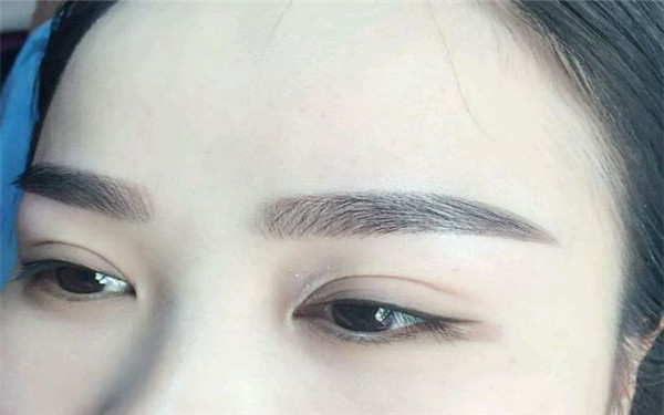 2023內(nèi)蒙古填充去除醫(yī)生在榜名單top10強(qiáng)匯集在此裴大偉、任明超、席瑞紅實力可靠