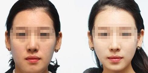 2023遵義水光針祛面部皺紋醫(yī)生排行榜前10強(qiáng)強(qiáng)勢入圍！蘇崇宇、代明星、王龍龍這些醫(yī)生值得選擇