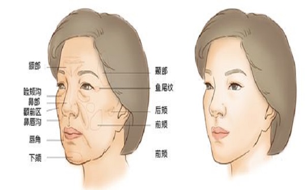 2023北京淡化頸部皺紋專(zhuān)家強(qiáng)榜TOP10技術(shù)整合！苗潤(rùn)靜、常雙明、劉暾實(shí)力技術(shù)更新中