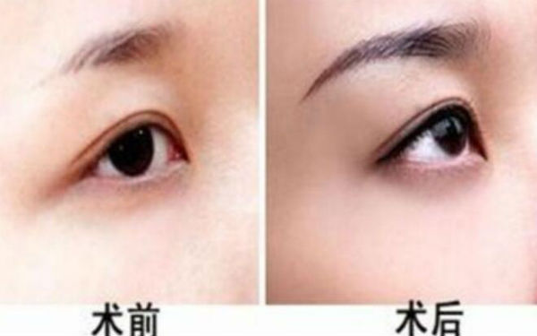 2023重慶水動力溶脂瘦大腿前10醫(yī)生新鮮名單發(fā)布！何林、向雪岑、趙映群口碑實力技術(shù)，一鍵直達！